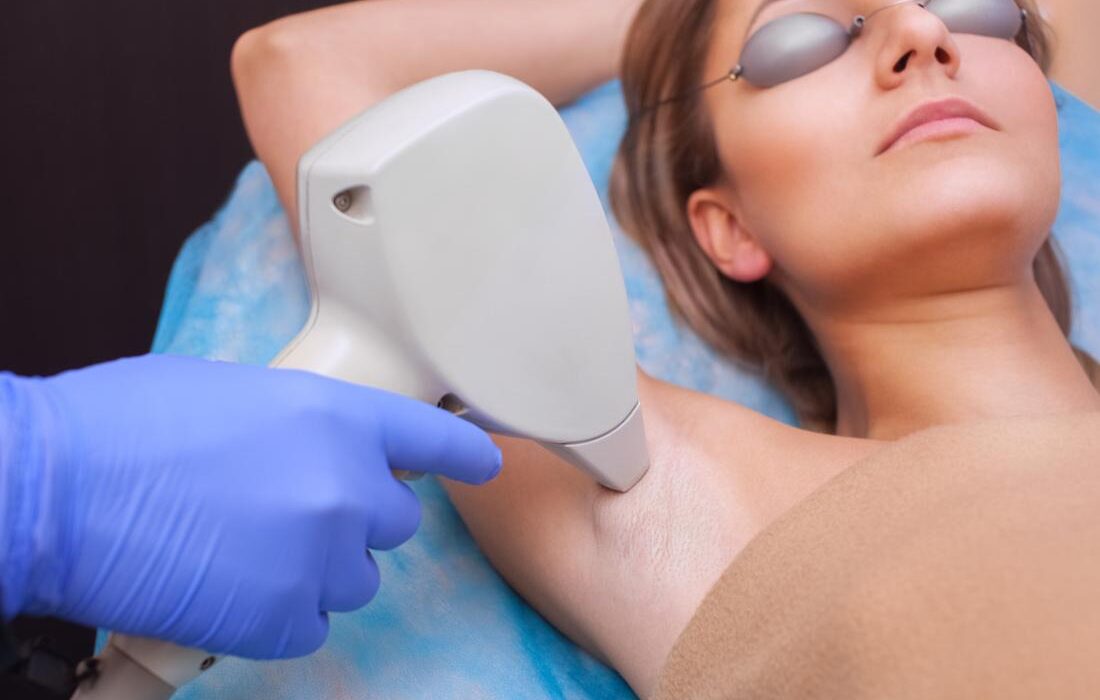 Some Common Side Effects of the Laser Hair Removal Process