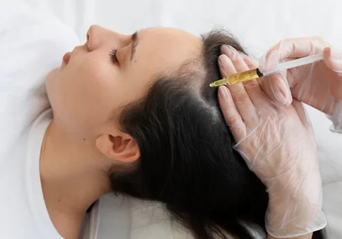 Hair Loss Treatment in Hong Kong: Common Questions People Ask