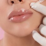 How Lip Fillers Restore Volume Lost with Age?