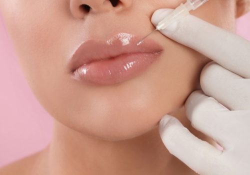 How Lip Fillers Restore Volume Lost with Age?