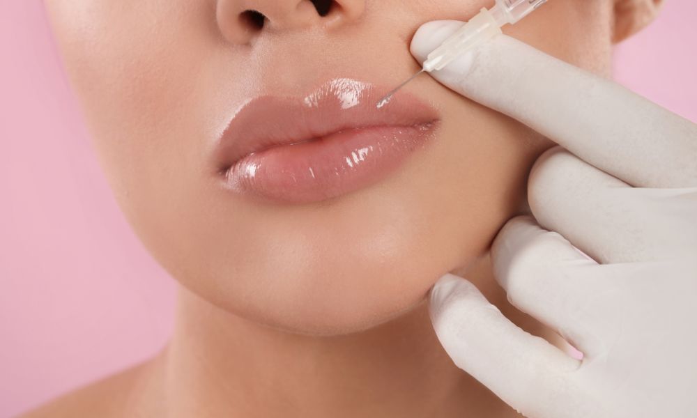 How Lip Fillers Restore Volume Lost with Age?